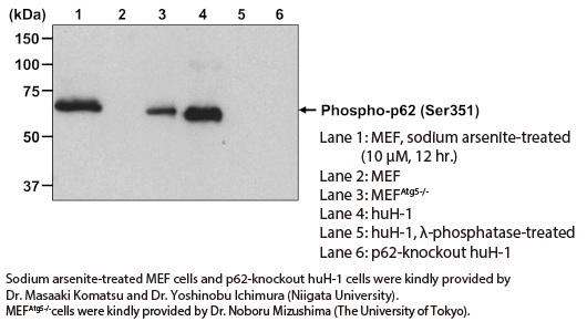 Anti-Phospho-p62 (SQSTM1) (Ser351) mAb（Code No. M217-3）Western blotting