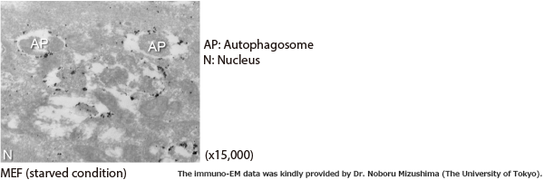 Anti-LC3 mAb（Code No. M152-3）Immuno-EM