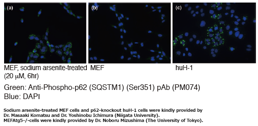 Anti-Phospho-p62 (SQSTM1) (Ser351) pAbCode No. PM074）Immunocytochemistry