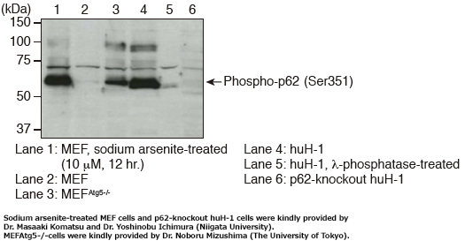 Anti-Phospho-p62 (SQSTM1) (Ser351) pAbCode No. PM074）Western blotting