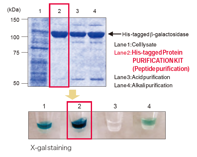 3310 Purification and enzymatic activity of N-terminal His-tagged β-galactosidase