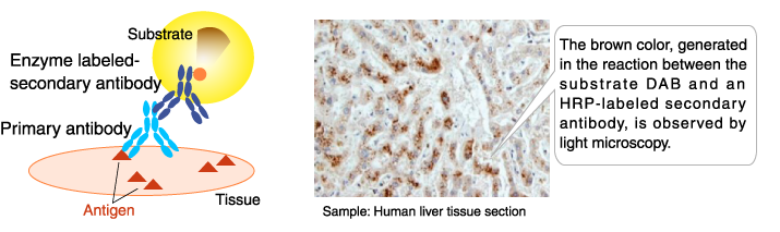 Application example of enzyme-labeled antibodies: Immunohistochemical staining